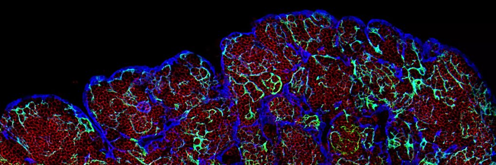 Evolution of adaptive immunity in vertebrates