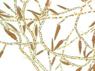 Lipinska Lab - Reproductive Isolation and Speciation in Brown Algae
